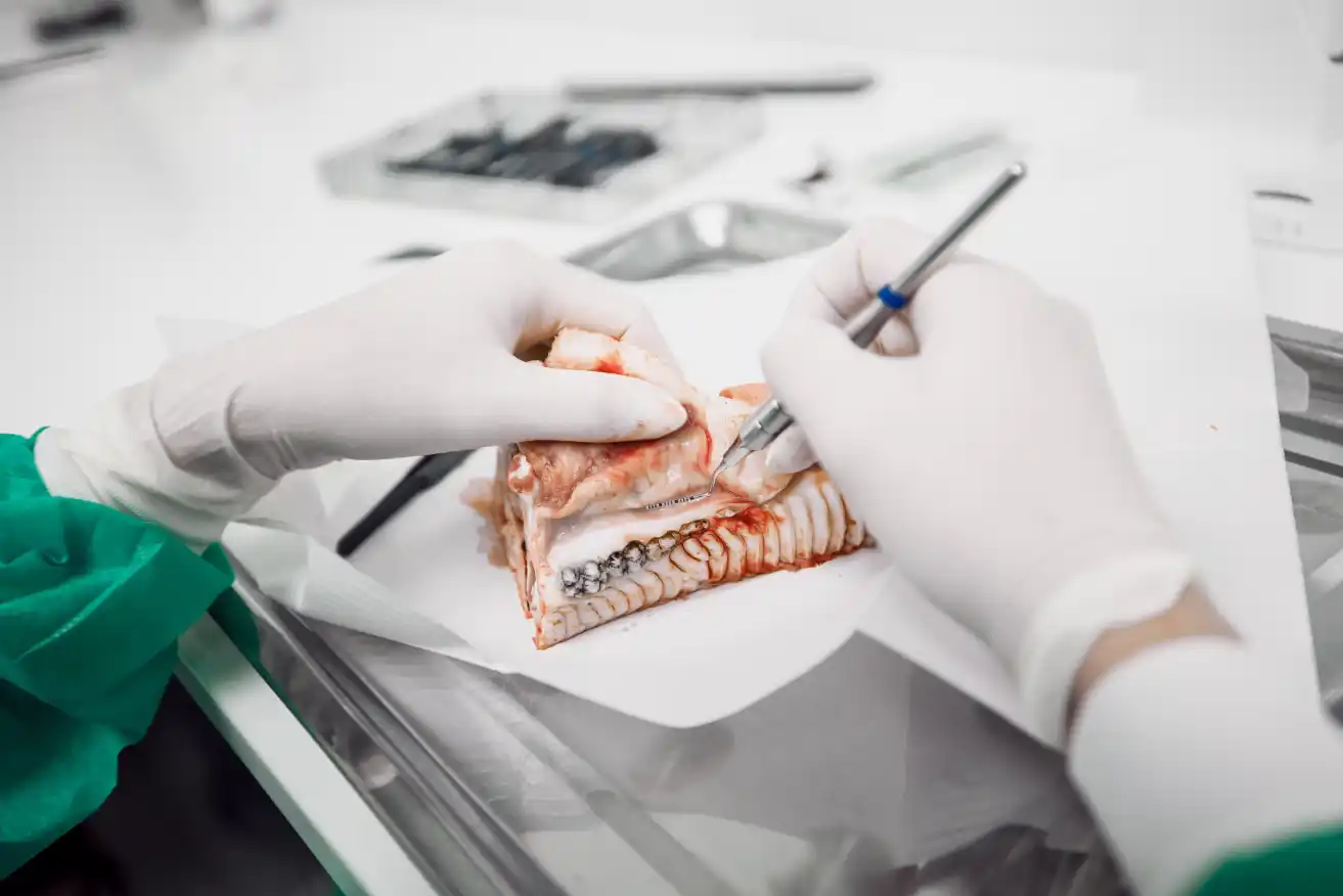 Algorytmy postępowania w leczeniu periodontologicznym pacjentów ortodontycznych