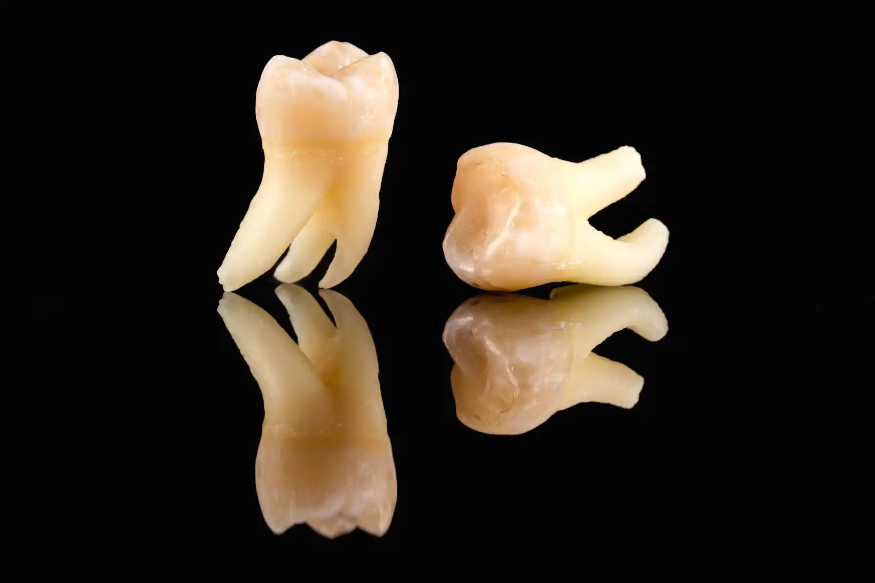 Laserowe Usuwanie Zębów Zatrzymanych