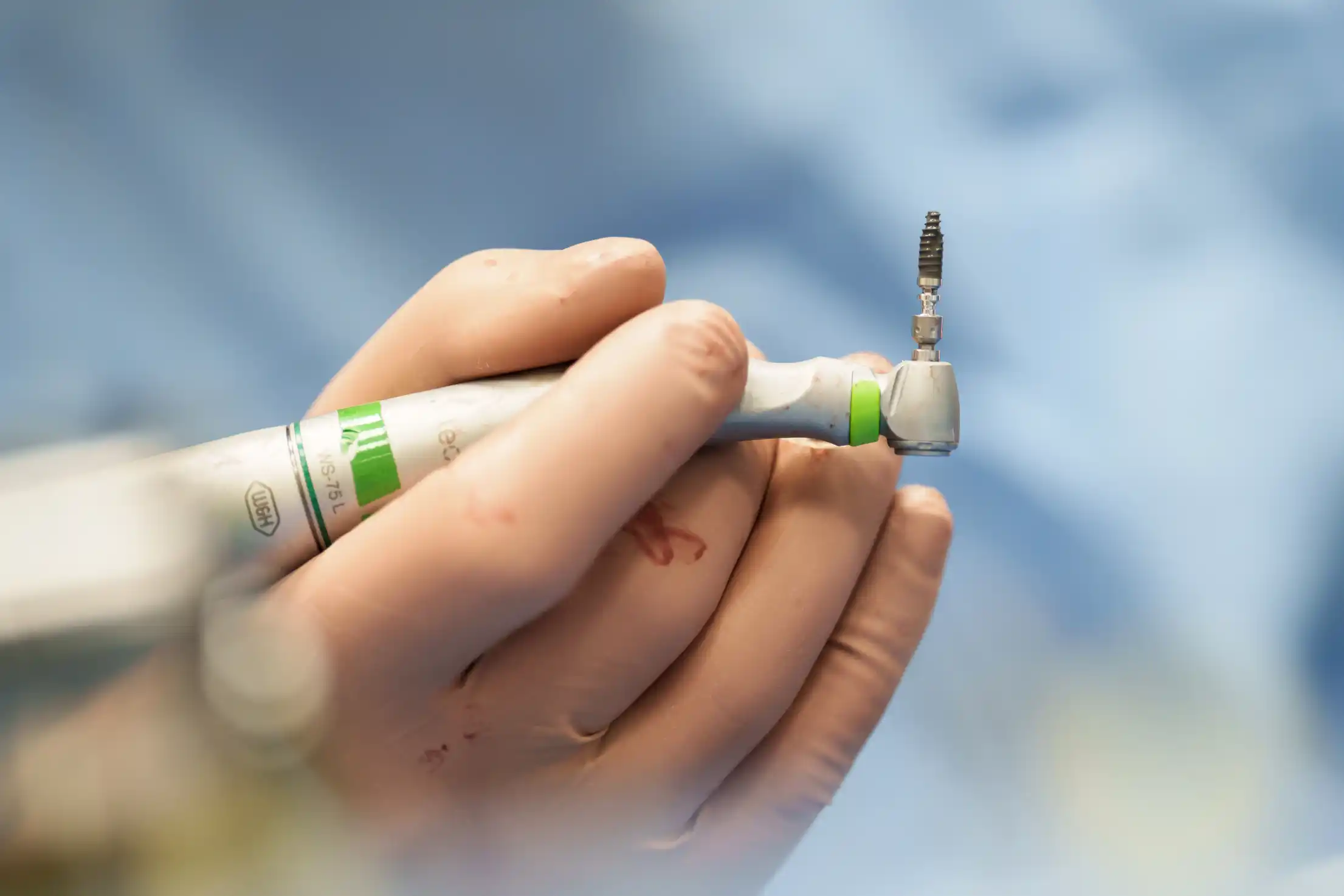 Precyzyjna Implantologia z wykorzystaniem Systemów PIC i SmartFlags