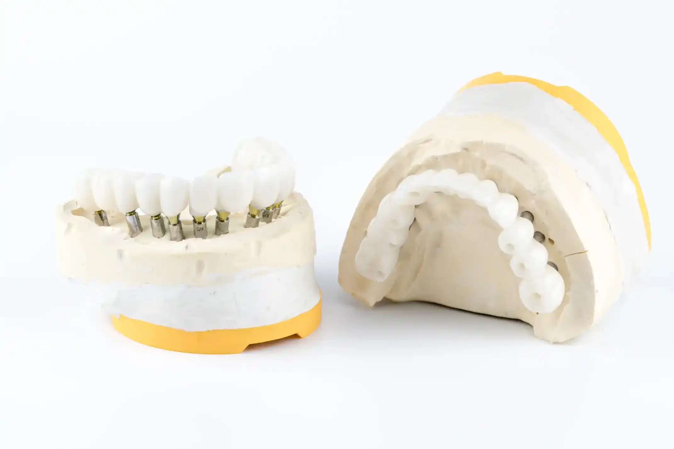 Okluzja i Biomechanika w Implantoprotetyce